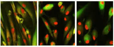 Chemické koktejly mohou omladit a zvrátit stáří senescentních lidských kožních buněk obnovením kompartmentalizace červeného fluorescenčního proteinu v jádře. Obrázek: Harvard University